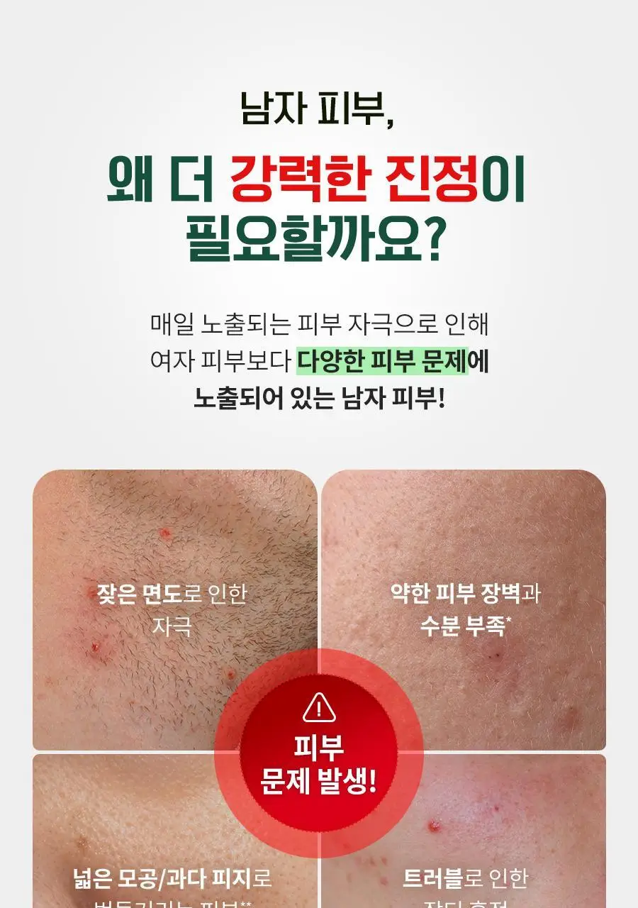 [리뉴얼/트러블/면도후] 닥터지 레드 블레미쉬 포 맨 진정 올인원 150ml 2종 (단품/증정 기획) 상세페이지 11